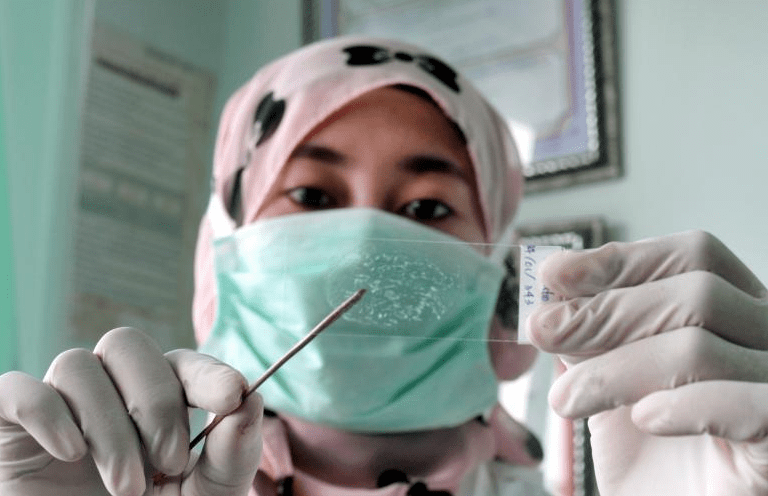Perang Melawan TBC