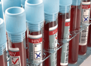 Dinkes Kota Batu Ubah Strategi Penanganan HIV, Skrining Kini Lebih Terarah