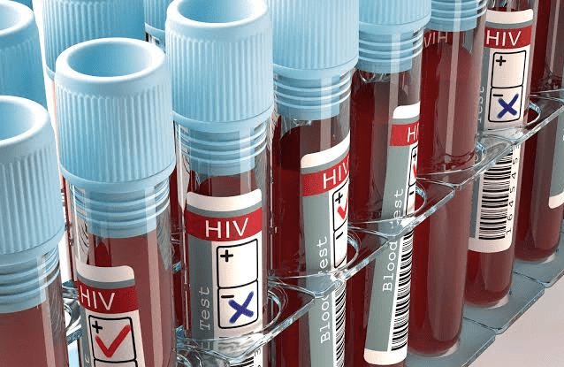 Dinkes Kota Batu Ubah Strategi Penanganan HIV, Skrining Kini Lebih Terarah