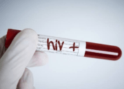 HIV AIDS