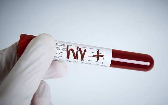 HIV AIDS